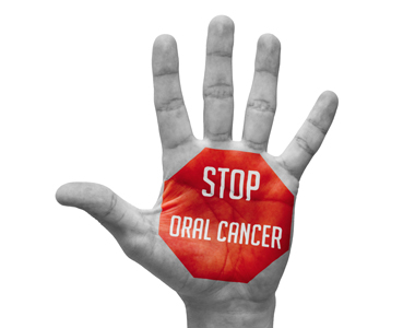 Top 5 Risk Factors for Oral Cancer