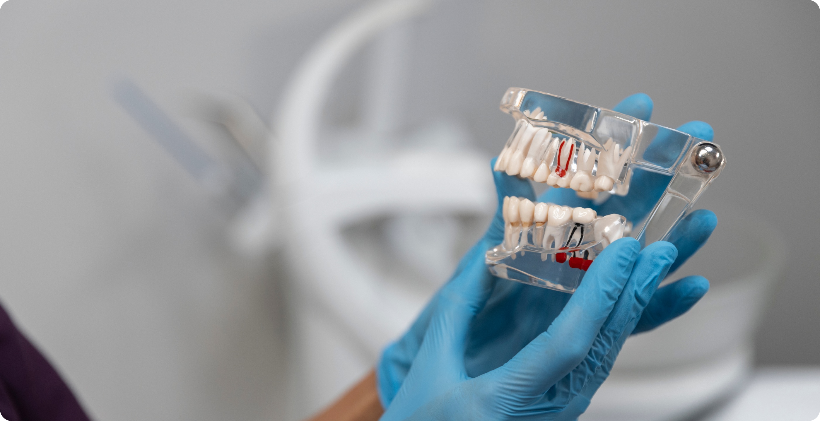 Dental Implant Service Banner Image