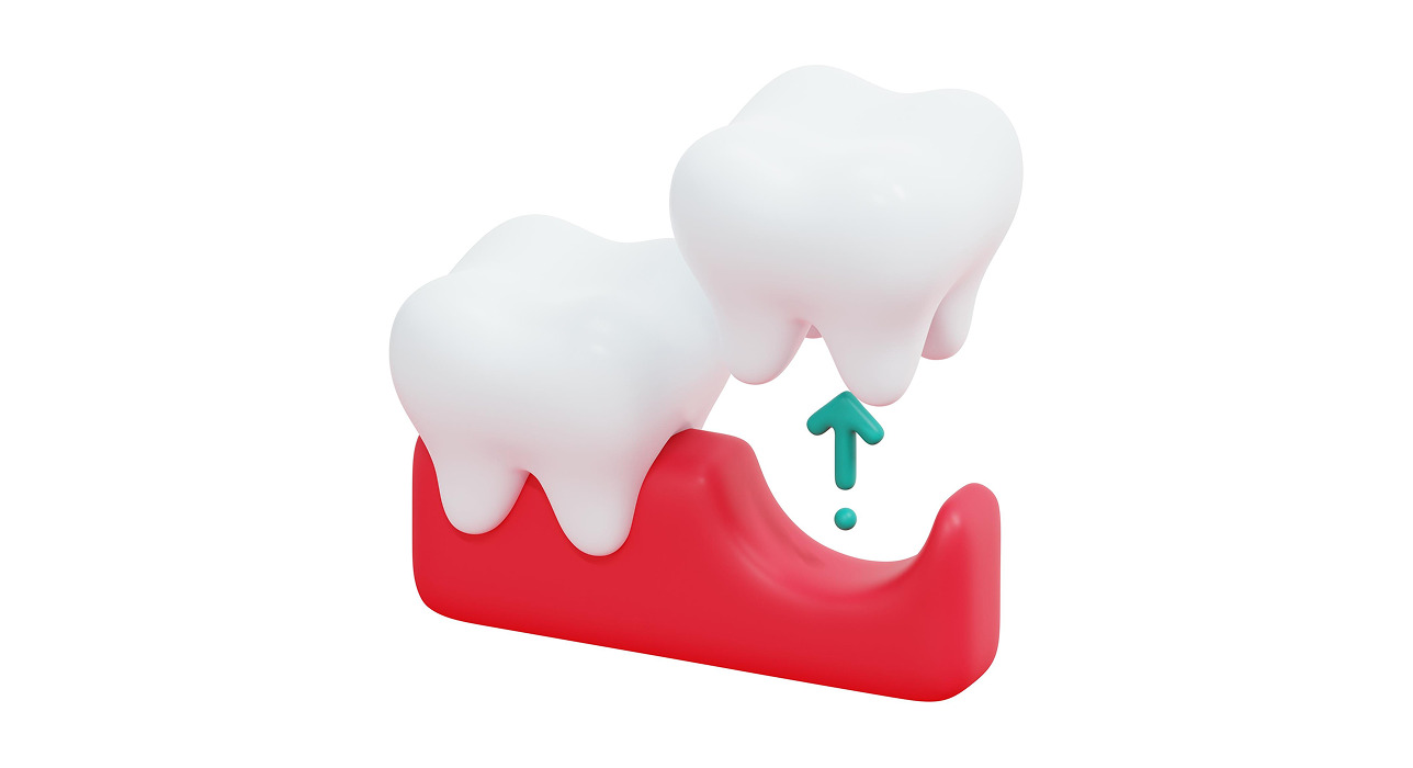 Tooth extraction
